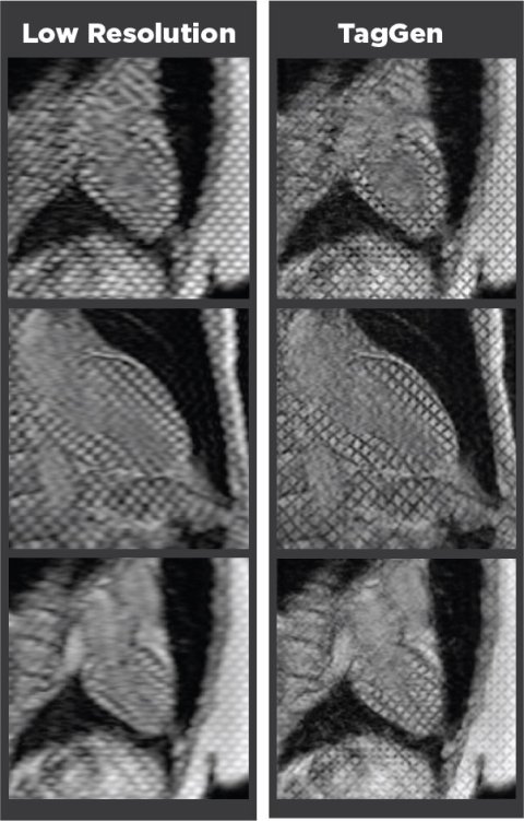 Two rows of MRI heart scans