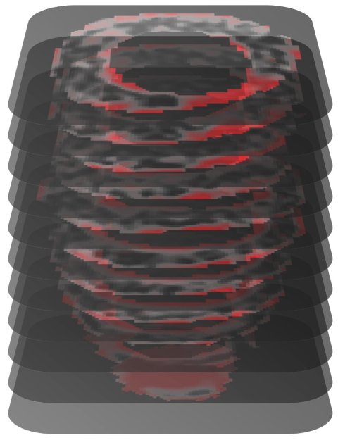 A vertical stack of cardiac MRI images