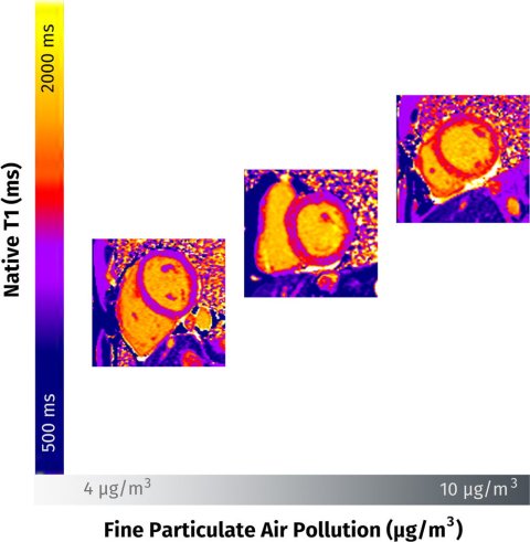 A graph linking the length of exposure to air pollution to heart damage