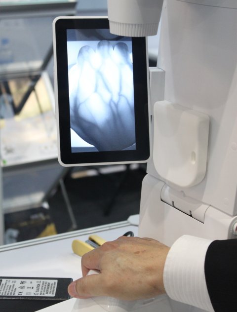 A special medical scanner showing the veins inside a person's hand