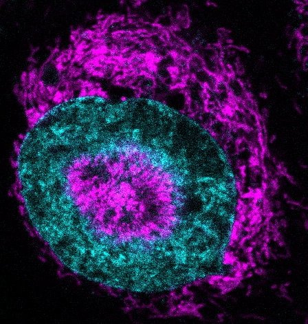 Closeup of a single cancer cell, in purple and cyan, against a black background