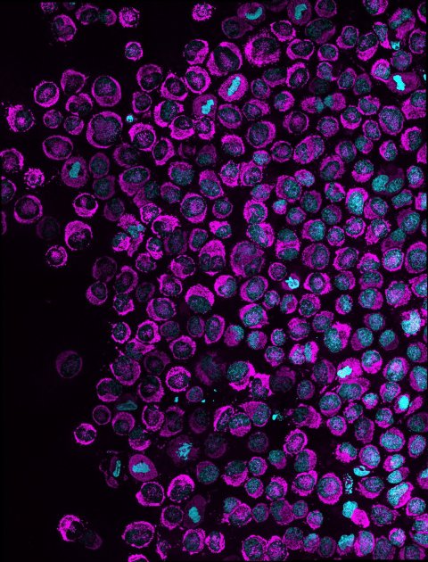 Many purple cells on a black background