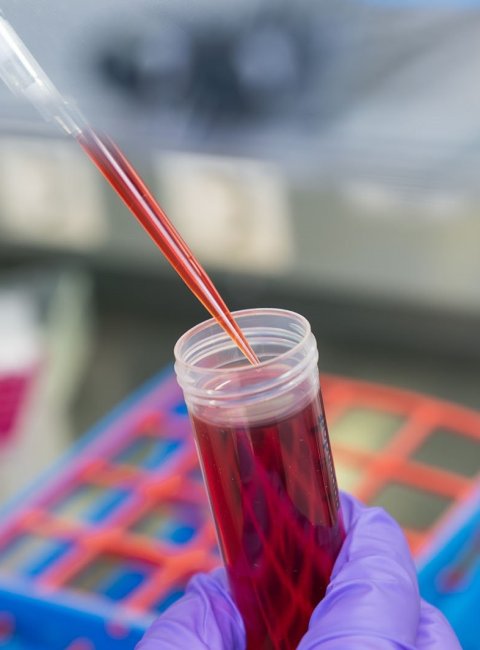 Ein mit Blut gefülltes Probenröhrchen, das mit einer Pipette befüllt wird. Im Hintergrund sind unscharf Laborgeräte zu sehen