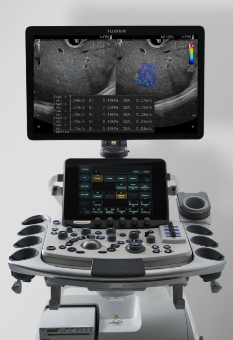 Frontal view of a medical diagnostic ultrasound system