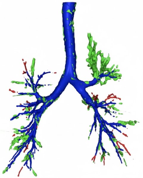 3D image of the branching structure of the human lungs in blue and green against a white background