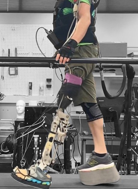 A person with a robotic prosthetic leg walking on a treadmill