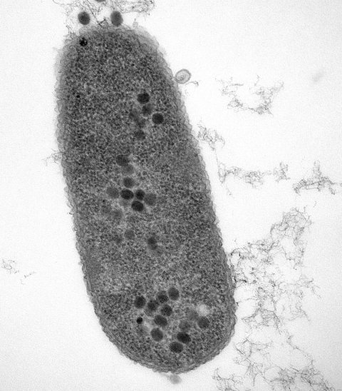 Phages attacking bacteria under the microscope