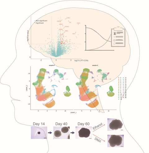 The silhouette of a human head and brain, with several diagrams of laboratory findings inside