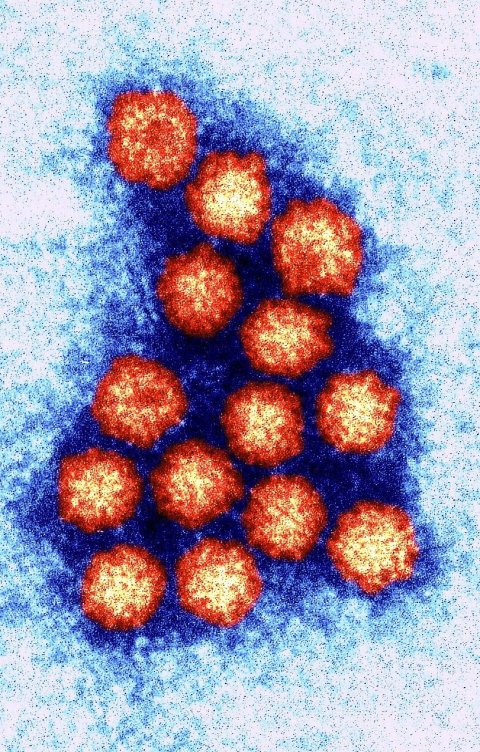 Colour-enhanced norovirus particles in yellow and red against a light blue background