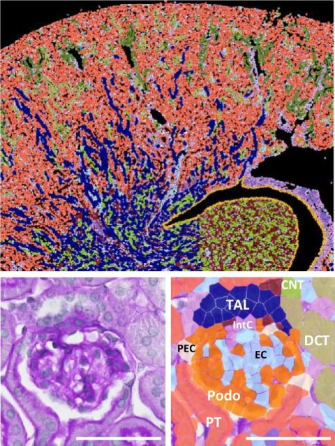 Drei Aufnahmen von Nierenzellen, mit unterschiedlichen Verfahen eingefärbt und mit Küzeln zum jeweiligen Zelltyp versehen