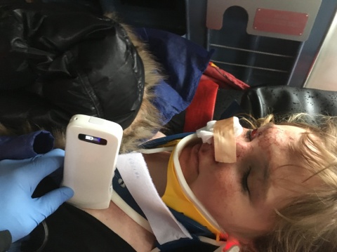 Prehospital ultrasound in rescue helicopter after trauma to rule out pneumothorax
