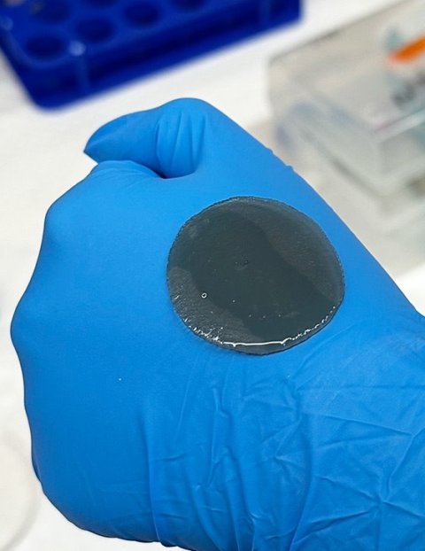 A dark round, slightly glistening patch on a hand wearing a blue protective rubber glove