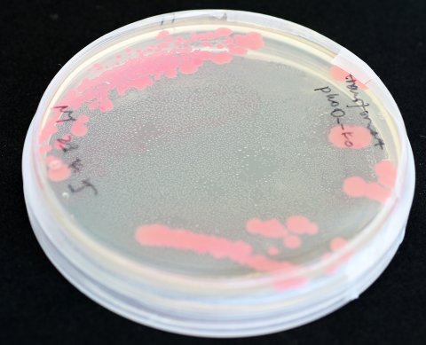 Eine Petrischale mit einer Bakterienkultur von Pseudomonas aeruginosa liegt auf einem schwarzen Untergrund