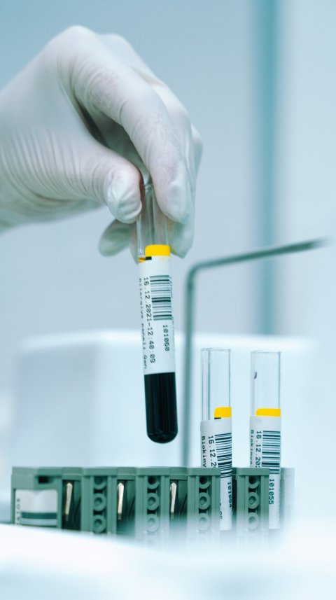 Hand in a white protective rubber glove is holding a test tube with blood over a holder rack