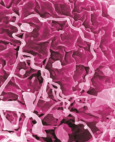 Microscopic image in pink of Treponema pallidum, the bacteria that cause syphilis