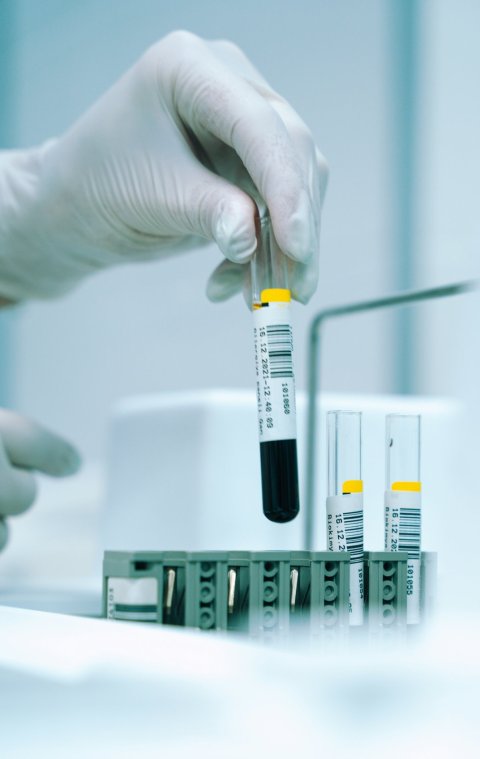 A hand in a white rubber glove taking a blood test tube out of a rack in a medical laboratory