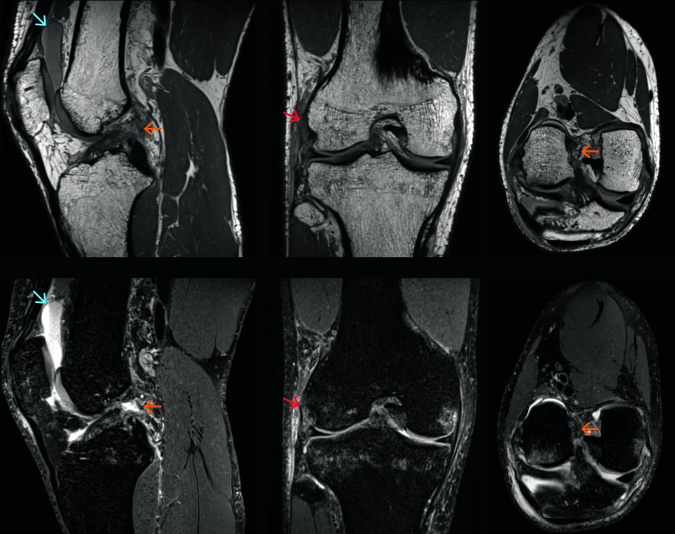 GOKnee3D: Siemens boosts MRI productivity with new application ...