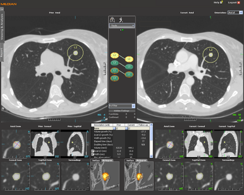 Turning a CT a virtual • healthcare-in-europe.com