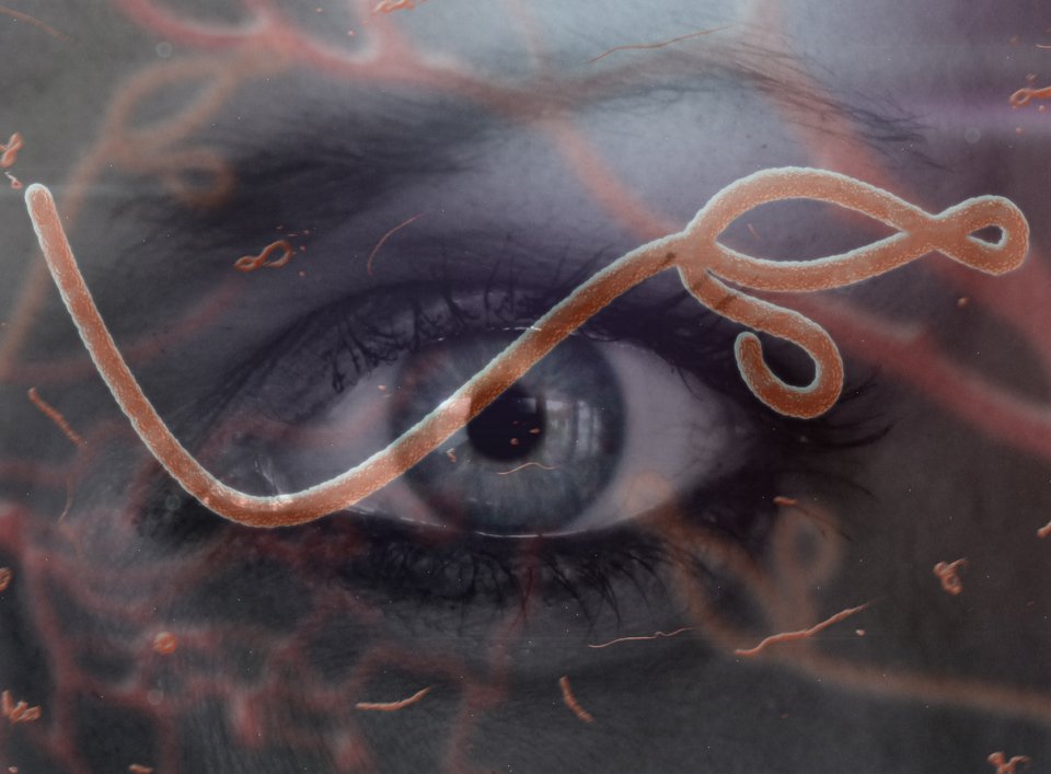 A perfect shelter How ebola lives on in the eyes of survivors