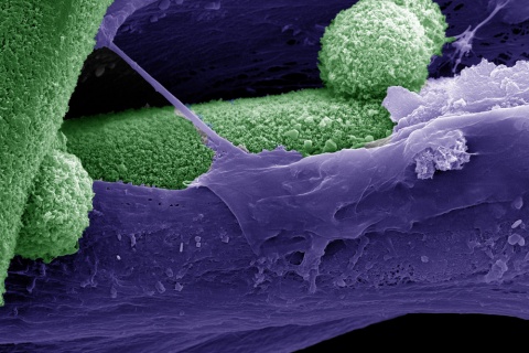 bone tissue under electron microscope