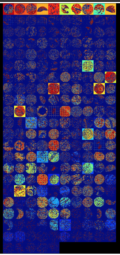 tissue microarrays heat maps