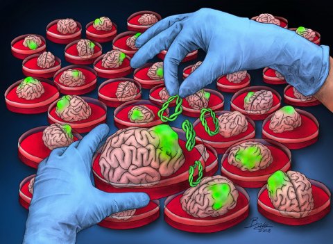 Illustration of person with blue lab gloves creating brain tumors in petri dishes