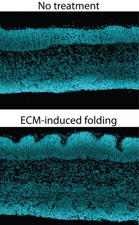 tessuto neocorticale del cervello umano