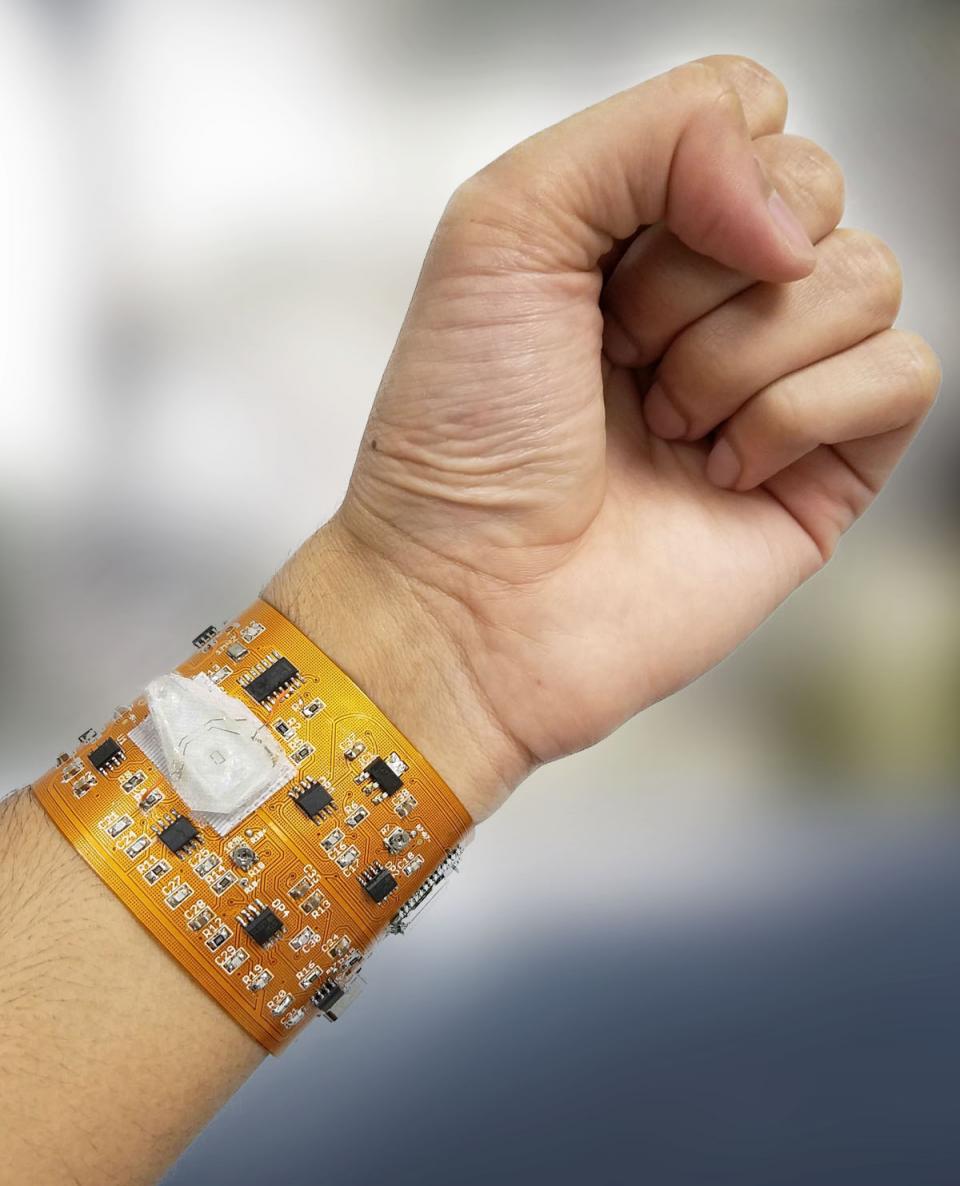 Smart wristband could monitor personal health •