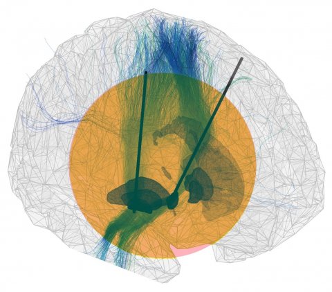 3d model of human brain