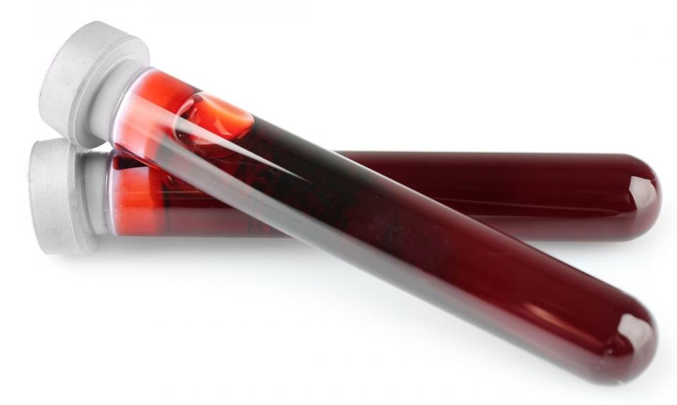 on venous blood sampling •
