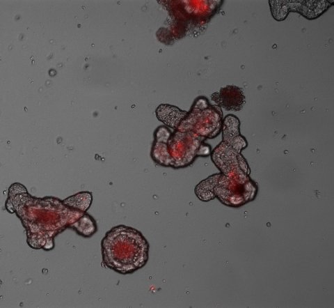 organoids under the microscope
