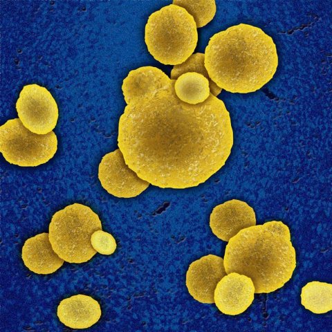 enzyme extended-spectrum beta-lactimases (ESBL)