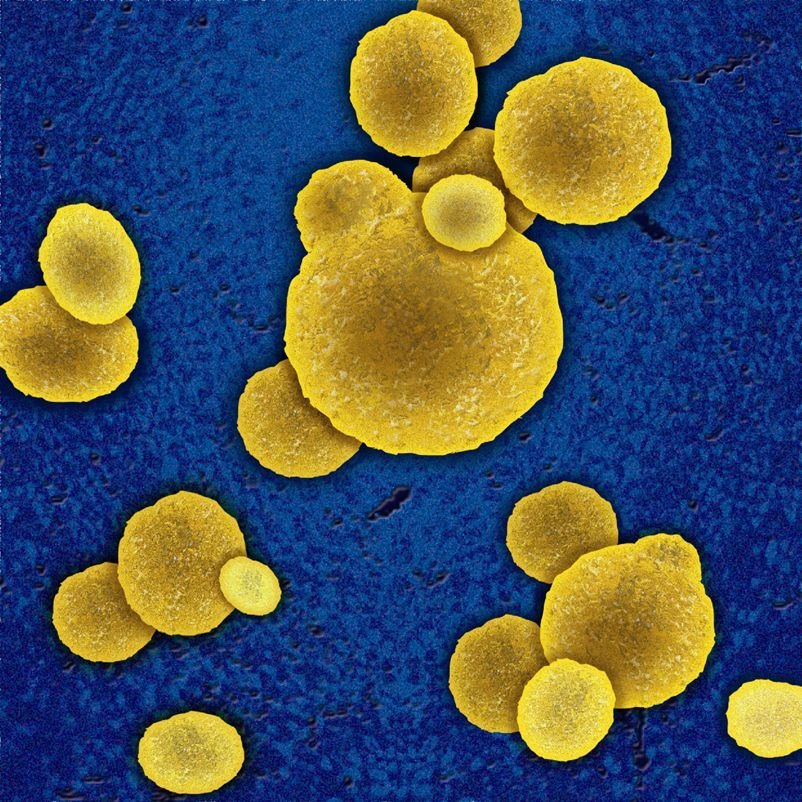 Staphylococcus aureus 5. S. aureus золотистый стафилококк. Сифилисный стафилококк. Золотисоыйстафилококк.