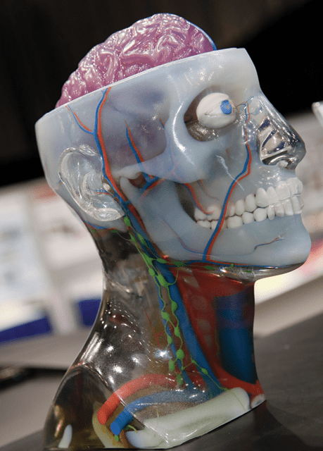 Will 3d Printing Bring Radiology To The Next Level